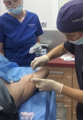 ¡Nuevo! Endoláser en Dermamedicin.